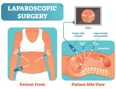 Τσαγκατακης Θωμάς - Ηράκλειο - Advanced Laparoscopy Surgery