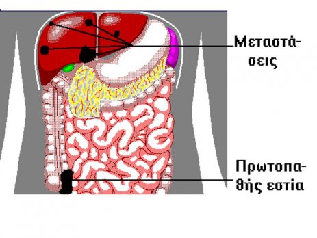 Doctor Tsagkatakis 